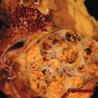 Blasted Pancreas - Carcinoma CD / Album